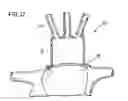 Fig. 08 - Universal cardiac introducer