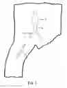 Fig. 02 - Facilitating catheter assembly