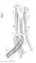 Fig. 06 - Balloon catheter retrieval device