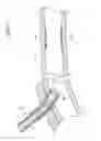 Fig. 07 - Balloon catheter retrieval device
