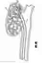 Fig. 07 - Activatable foam expandable implantable medical device and method of use