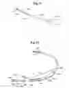 Fig. 09 - Methods for inducing fibrillation utilizing subcutaneous electrodes