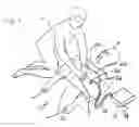Fig. 02 - Rhythm identification in compression corrupted ECG signal