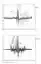 Fig. 07 - Rhythm identification in compression corrupted ECG signal