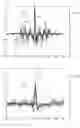 Fig. 09 - Rhythm identification in compression corrupted ECG signal