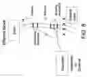 Fig. 09 - Method and system for vagal blocking and/or vagal stimulation to provide therapy for obesity and other gastrointestinal disorders
