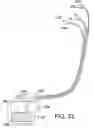 Fig. 33 - Method and system for vagal blocking and/or vagal stimulation to provide therapy for obesity and other gastrointestinal disorders