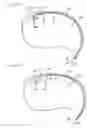 Fig. 19 - Method of intravascularly delivering stimulation leads into brain