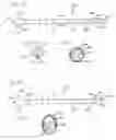 Fig. 32 - Method of intravascularly delivering stimulation leads into brain