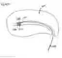 Fig. 37 - Method of intravascularly delivering stimulation leads into brain