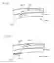 Fig. 48 - Method of intravascularly delivering stimulation leads into brain