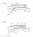Fig. 50 - Method of intravascularly delivering stimulation leads into brain