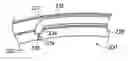 Fig. 01 - Method of intravascularly delivering stimulation leads into direct contact with tissue