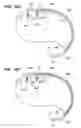 Fig. 07 - Method of intravascularly delivering stimulation leads into direct contact with tissue