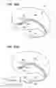 Fig. 22 - Method of intravascularly delivering stimulation leads into direct contact with tissue