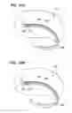 Fig. 33 - Method of intravascularly delivering stimulation leads into direct contact with tissue