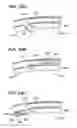 Fig. 43 - Method of intravascularly delivering stimulation leads into direct contact with tissue