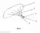 Fig. 04 - Acoustic-optical therapeutical devices and methods