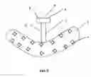 Fig. 06 - Acoustic-optical therapeutical devices and methods