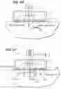 Fig. 31 - Tissue surface treatment apparatus and method