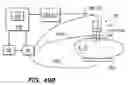 Fig. 34 - Tissue surface treatment apparatus and method