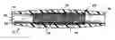 Fig. 01 - Suture sleeve