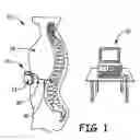 Fig. 02 - Implantable electrical connector system