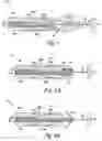 Fig. 04 - Myocardial lead