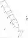 Fig. 05 - Myocardial lead