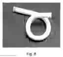 Fig. 06 - Vascular prosthesis and method for production thereof