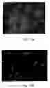 Fig. 08 - Vascular prosthesis and method for production thereof