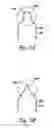 Fig. 08 - Methods for venous valve replacement with a catheter