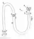 Fig. 09 - Methods for venous valve replacement with a catheter