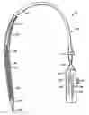 Fig. 01 - Methods and apparatus for endovascularly replacing a patient's heart valve