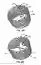 Fig. 04 - Methods and apparatus for endovascularly replacing a patient's heart valve