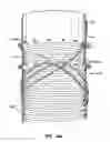 Fig. 07 - Methods and apparatus for endovascularly replacing a patient's heart valve