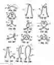 Fig. 11 - Methods and apparatus for endovascularly replacing a patient's heart valve