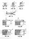 Fig. 13 - Methods and apparatus for endovascularly replacing a patient's heart valve