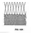 Fig. 15 - Methods and apparatus for endovascularly replacing a patient's heart valve