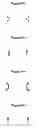 Fig. 20 - Methods and apparatus for endovascularly replacing a patient's heart valve