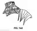 Fig. 23 - Methods and apparatus for endovascularly replacing a patient's heart valve