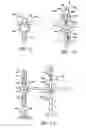 Fig. 05 - Methods and apparatus for endovascularly replacing a patient's heart valve