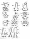 Fig. 11 - Methods and apparatus for endovascularly replacing a patient's heart valve