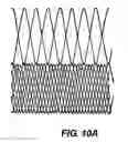 Fig. 15 - Methods and apparatus for endovascularly replacing a patient's heart valve