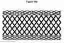 Fig. 16 - Methods and apparatus for endovascularly replacing a patient's heart valve