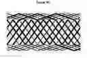 Fig. 17 - Methods and apparatus for endovascularly replacing a patient's heart valve