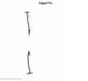 Fig. 19 - Methods and apparatus for endovascularly replacing a patient's heart valve