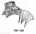 Fig. 23 - Methods and apparatus for endovascularly replacing a patient's heart valve