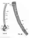 Fig. 03 - Methods and apparatus for endovascularly replacing a patient's heart valve
