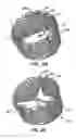 Fig. 04 - Methods and apparatus for endovascularly replacing a patient's heart valve